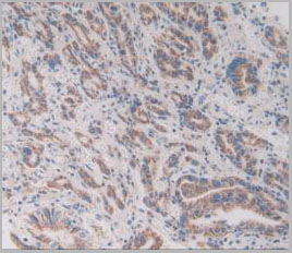 product-image-AAA20071_IHC4.jpg