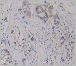 product-image-AAA20072_IHC10.jpg