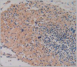 product-image-AAA20072_IHC3.jpg