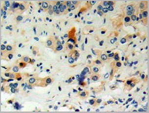 product-image-AAA20072_IHC8.jpg