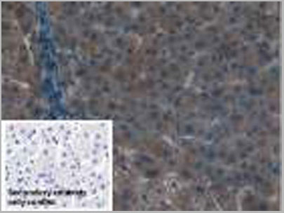 product-image-AAA20073_IHC.jpg