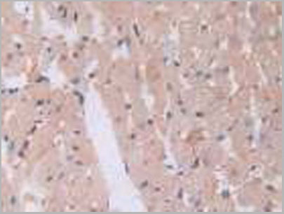 product-image-AAA20074_IHC3.jpg