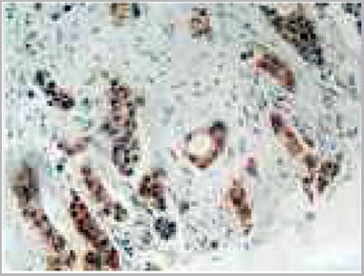 product-image-AAA20075_IHC2.jpg