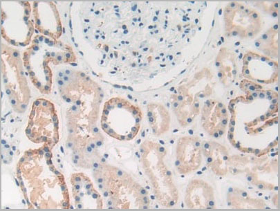 product-image-AAA20075_IHC4.jpg