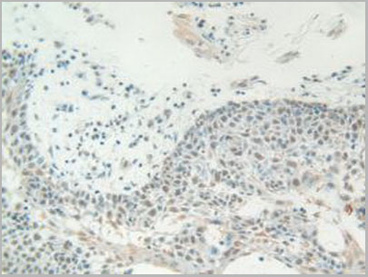 product-image-AAA20075_IHC5.jpg
