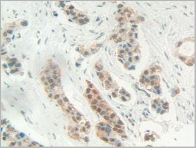 product-image-AAA20075_IHC6.jpg