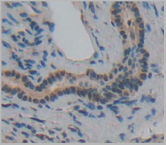 product-image-AAA20076_IHC6.jpg