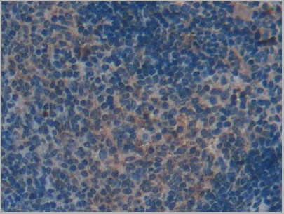 product-image-AAA20077_IHC5.jpg