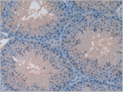 product-image-AAA20077_IHC6.jpg