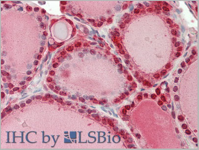 product-image-AAA20078_IHC8.jpg