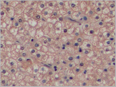 product-image-AAA20078_IHC9.jpg