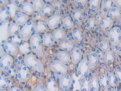 product-image-AAA20080_IHC3.jpg