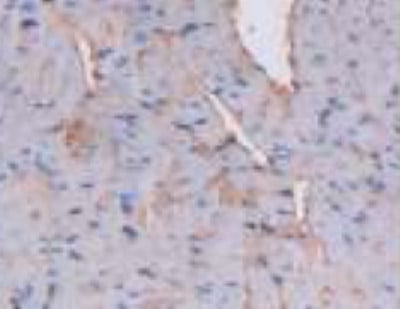 product-image-AAA20080_IHC4.jpg