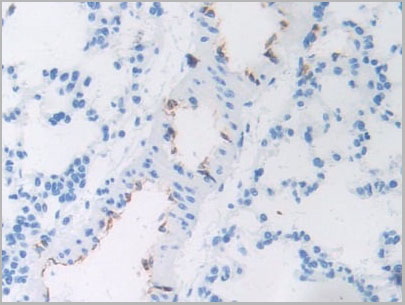 product-image-AAA20090_IHC5.jpg
