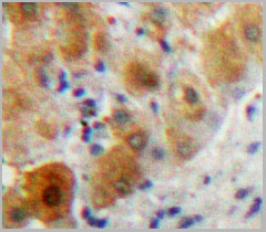 product-image-AAA20095_IHC3.jpg