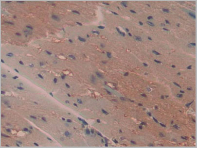 product-image-AAA20098_IHC7.jpg