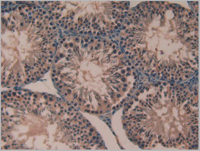 product-image-AAA20098_IHC8.jpg