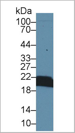 product-image-AAA20098_WB.jpg