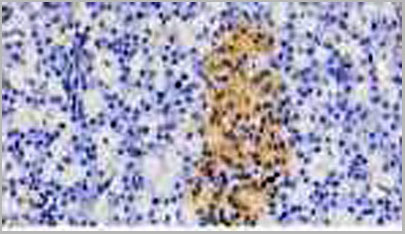 product-image-AAA20104_IHC2.jpg