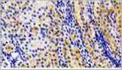 product-image-AAA20104_IHC3.jpg