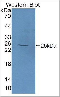 product-image-AAA20104_WB.jpg