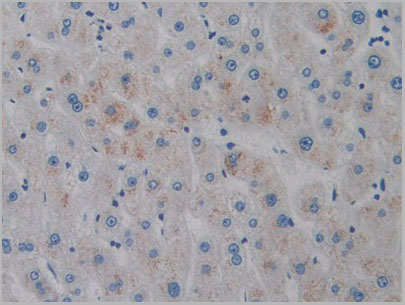 product-image-AAA20107_IHC6.jpg