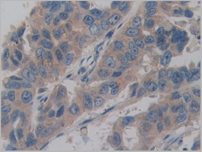 product-image-AAA20107_IHC7.jpg