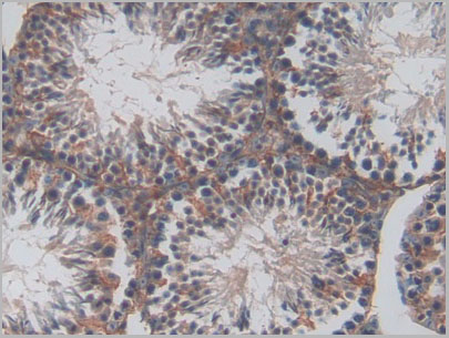 product-image-AAA20114_IHC2.jpg