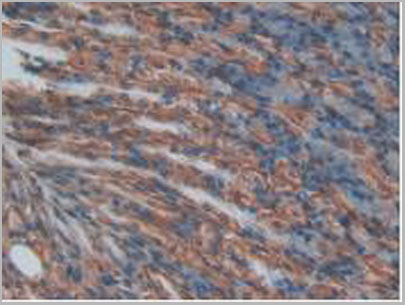 product-image-AAA20114_IHC3.jpg