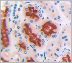 product-image-AAA20115_IHC2.jpg