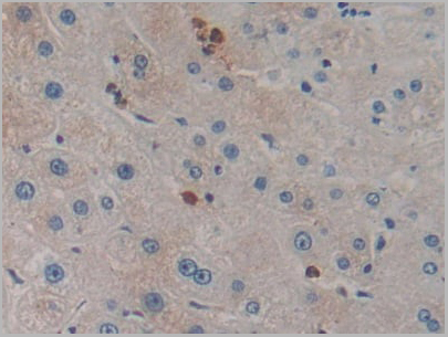 product-image-AAA20116_IHC4.jpg