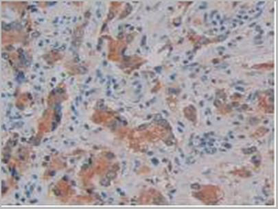 product-image-AAA20116_IHC5.jpg