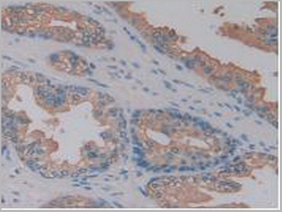 product-image-AAA20116_IHC6.jpg