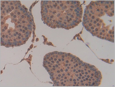 product-image-AAA20117_IHC7.jpg