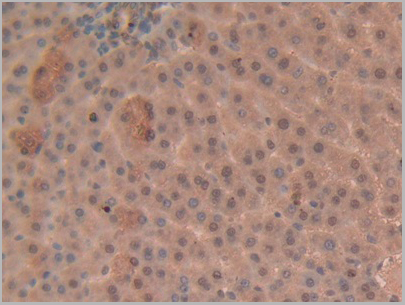 product-image-AAA20117_IHC8.jpg