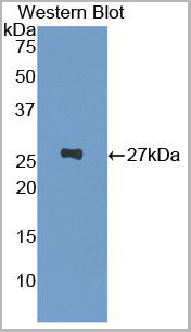 product-image-AAA20117_WB6.jpg