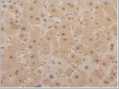 product-image-AAA20122_IHC5.jpg