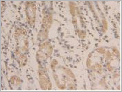 product-image-AAA20122_IHC6.jpg