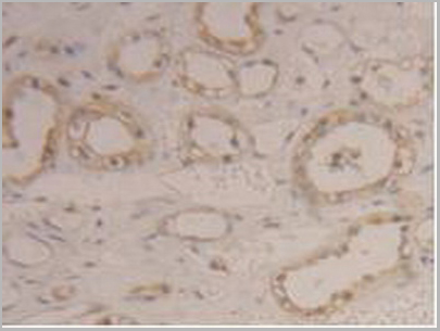 product-image-AAA20122_IHC8.jpg