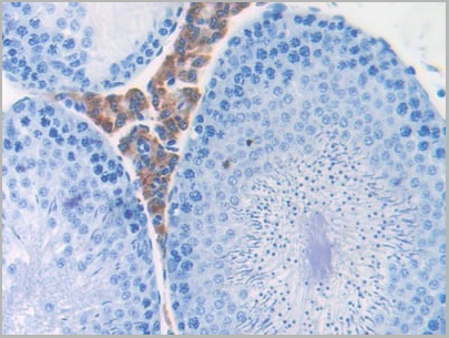 product-image-AAA20123_IHC4.jpg