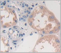 product-image-AAA20126_IHC3.jpg