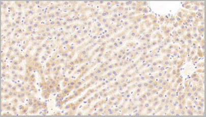 product-image-AAA20130_IHC4.jpg