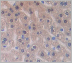 product-image-AAA20133_IHC3.jpg