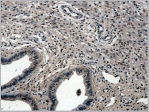 product-image-AAA20134_IHC2.gif