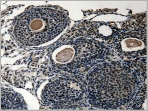 product-image-AAA20134_IHC3.gif