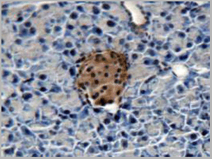 product-image-AAA20134_IHC4.gif