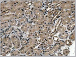 product-image-AAA20134_IHC5.gif