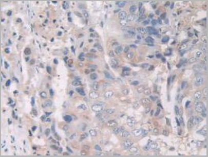 product-image-AAA20135_IHC2.jpg