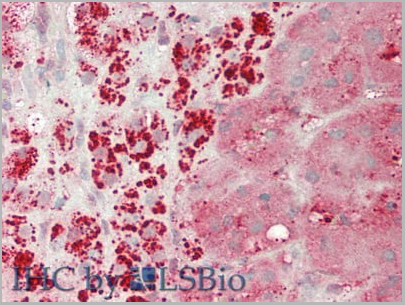 product-image-AAA20135_IHC3.jpg