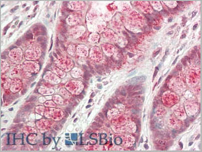 product-image-AAA20135_IHC4.jpg
